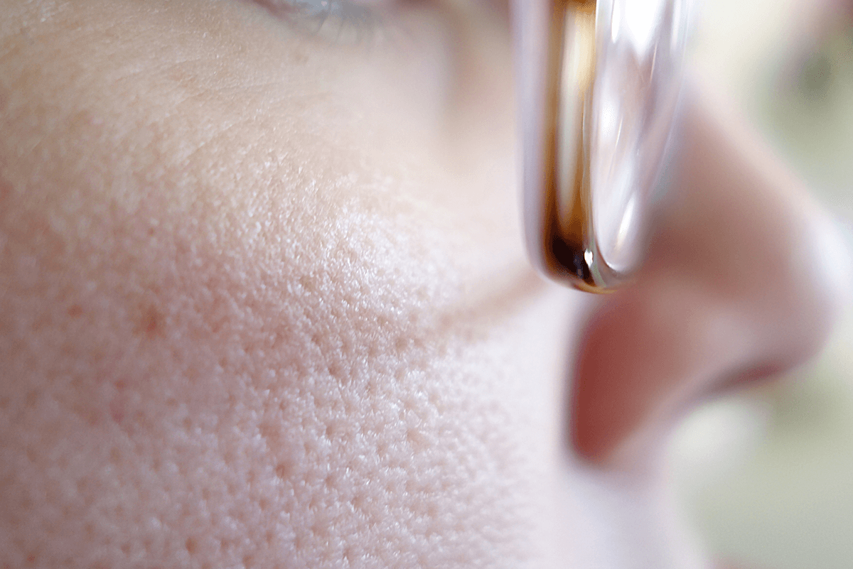 Why Your Pores Look Huge—And How to Shrink Their Appearance