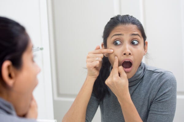 Ask Kerry: Whiteheads V. Milia