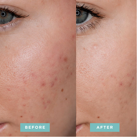 EGF Activating Serum