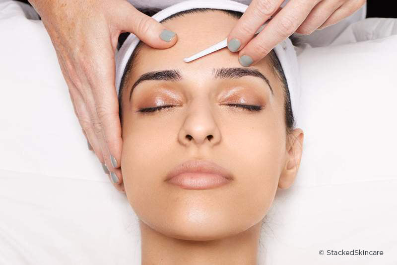 Woman on a spa table receiving a treatment with the StackedSkincare Dermaplaning Tool