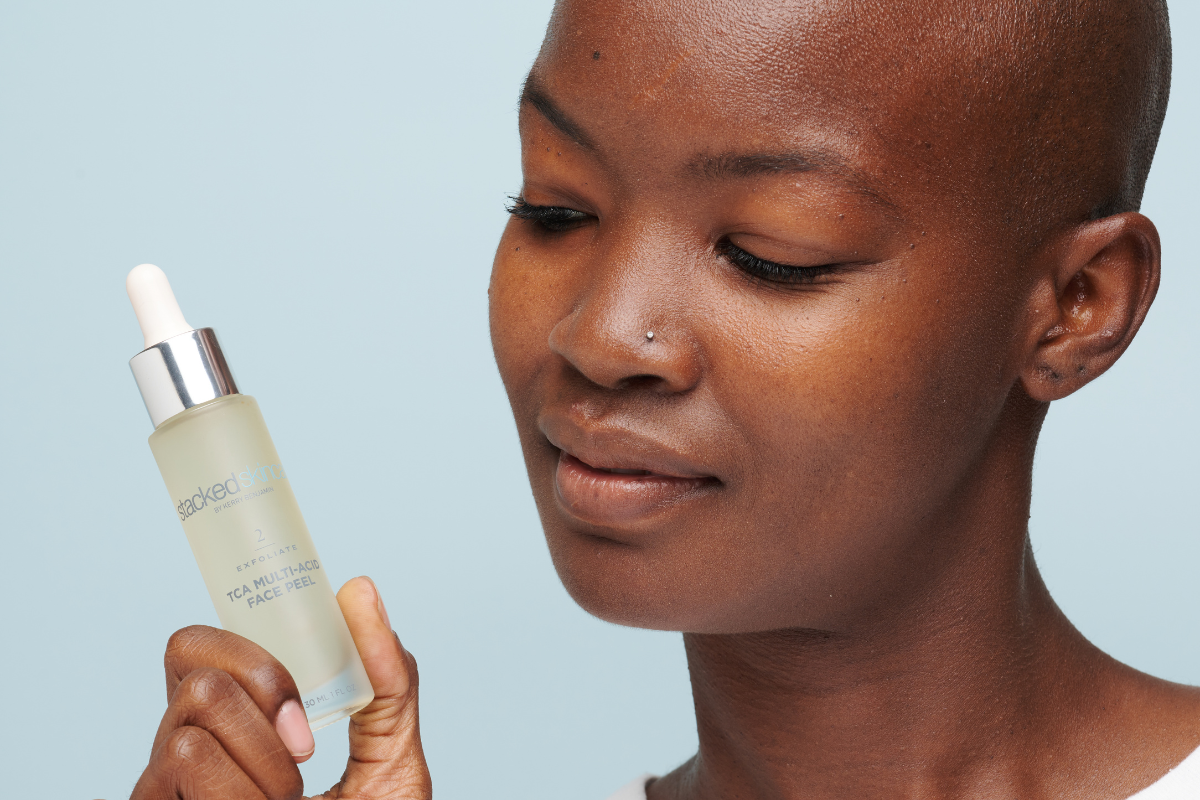 Should You Pop Your Pimples?