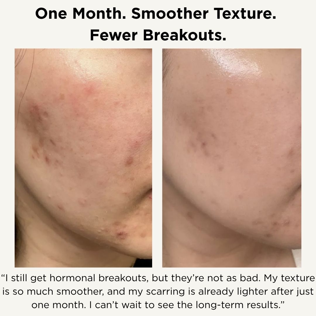 The Skin Renewal System