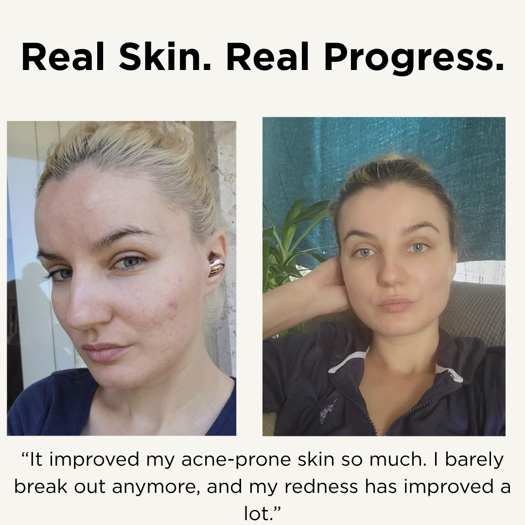 Advanced Retinol Serum