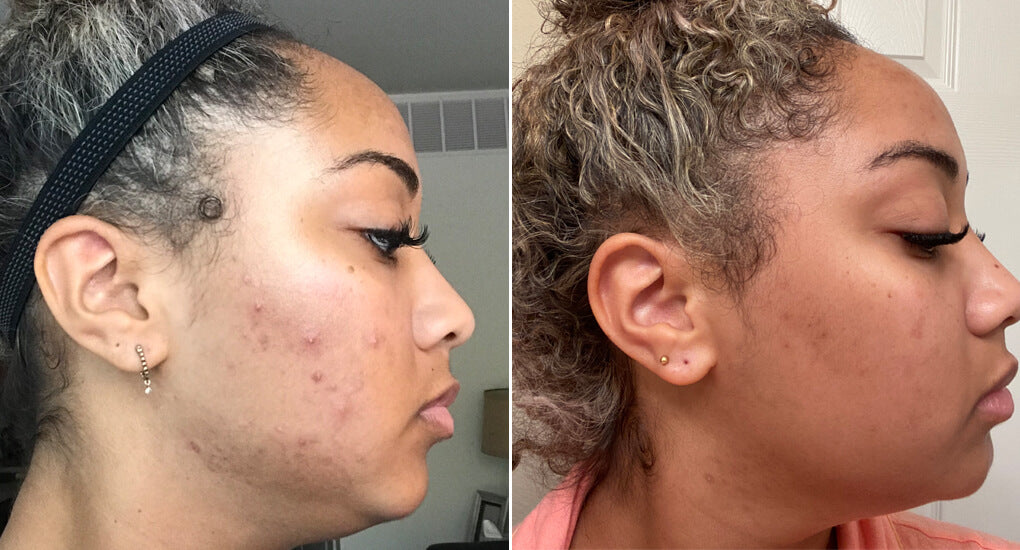 The Skin Renewal System