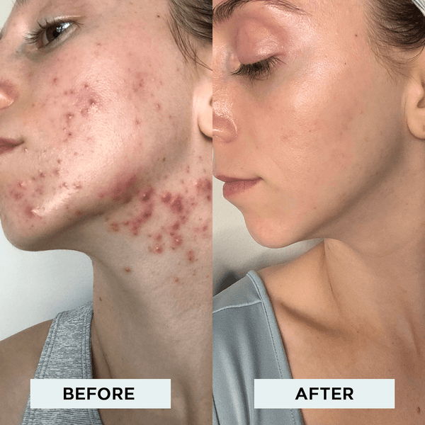 My face transformation 🤯 the BEFORE ➡️ NOW!! I struggled